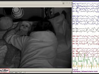 Flashing lights and epileptic spasms: should we be routinely performing intermittent photic stimulation in infants?