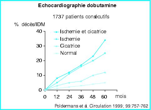 John Libbey Eurotext Medecine Therapeutique Cardiologie Echocardiographie De Stress Dobutamine Ou Effort