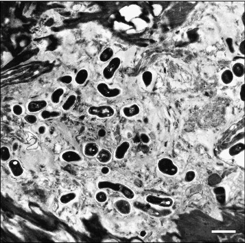 langerhans cells electron microscopy