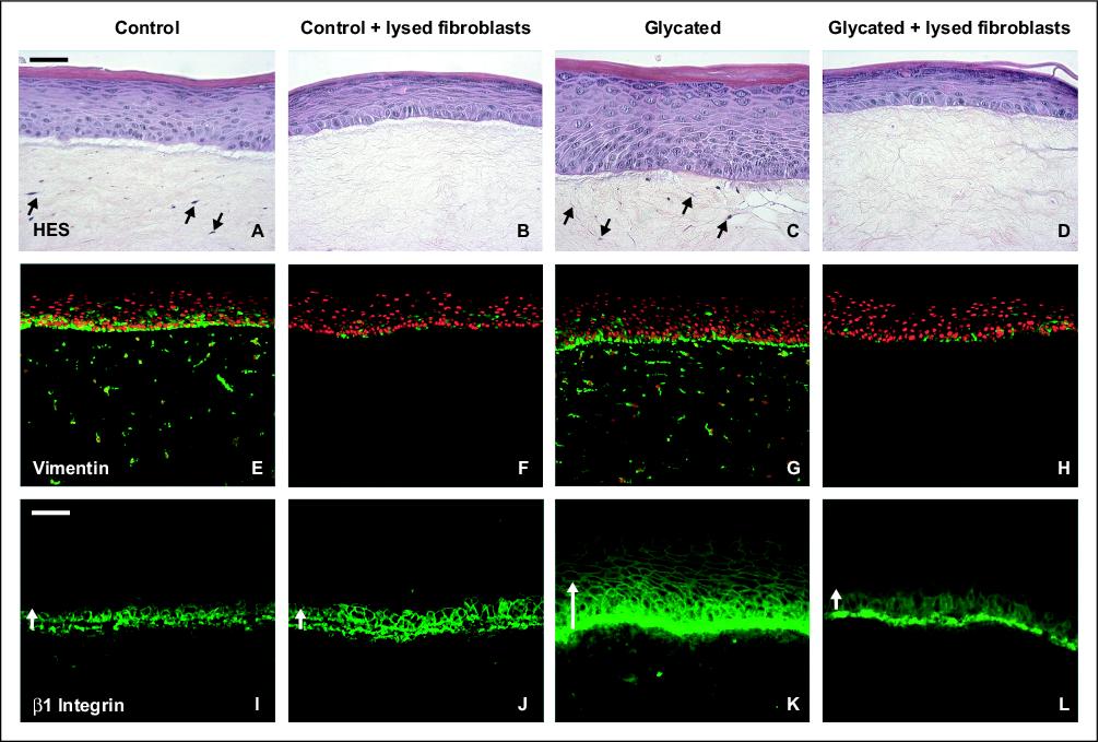 John Libbey Eurotext European Journal Of Dermatology Collagen Glycation Triggers The Formation Of Aged Skin In Vitro