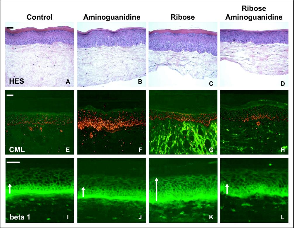 John Libbey Eurotext European Journal Of Dermatology Collagen Glycation Triggers The Formation Of Aged Skin In Vitro