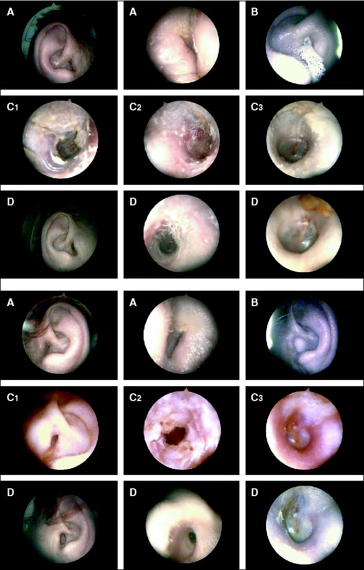 John Libbey Eurotext European Journal Of Dermatology Topical Tacrolimus Treatment For Chronic Dermatitis Of The Ear