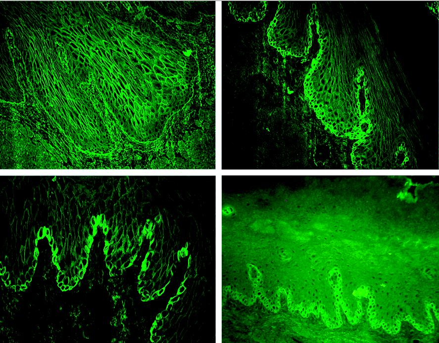 Linear Immunofluorescence