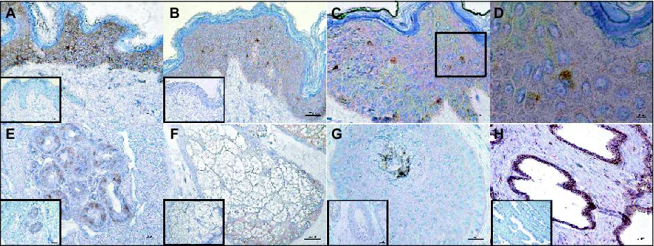 John Libbey Eurotext European Journal Of Dermatology Expression Of Estrogen Related Receptor Beta Errb In Human Skin