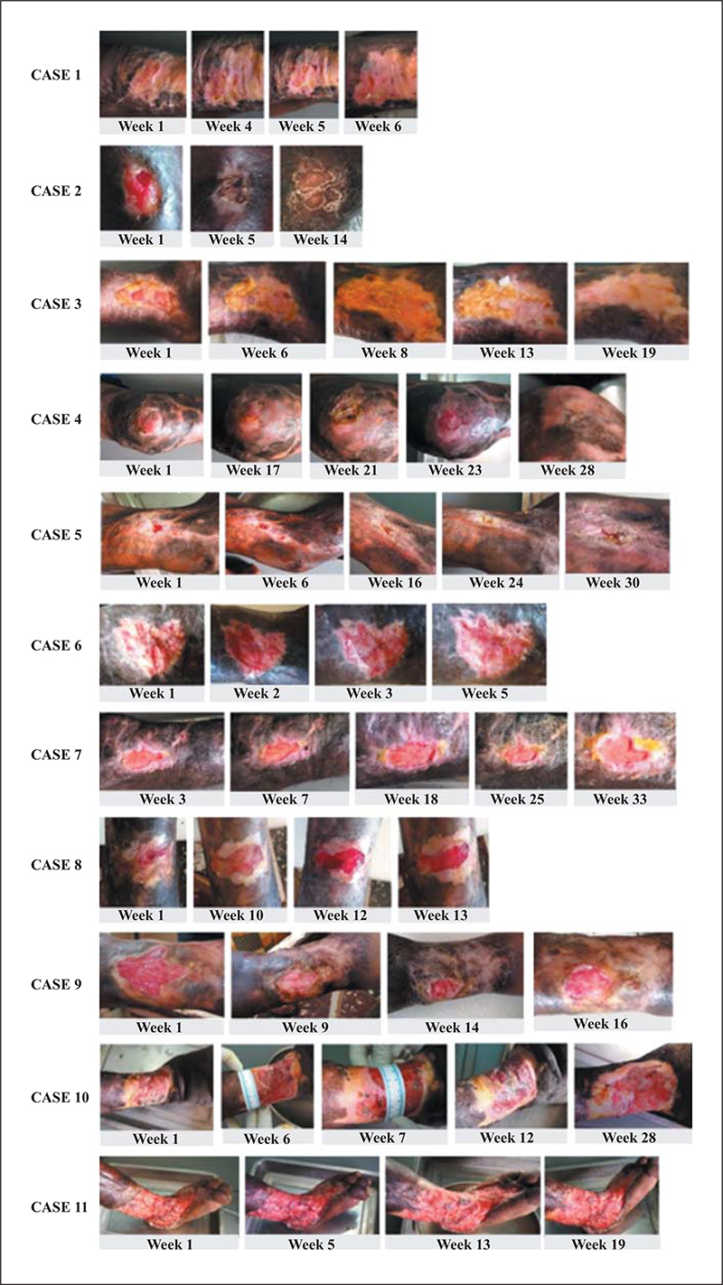 JLE European Journal Of Dermatology Nutritional Status And Wound