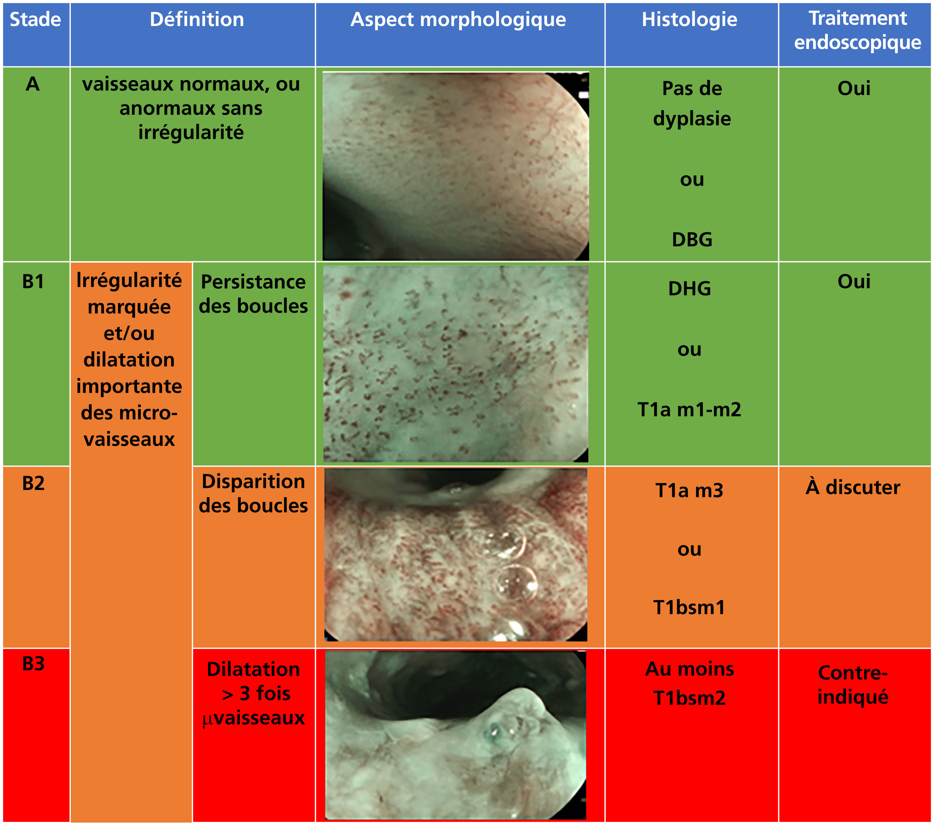 Jle H Pato Gastro Oncologie Digestive Prise En Charge