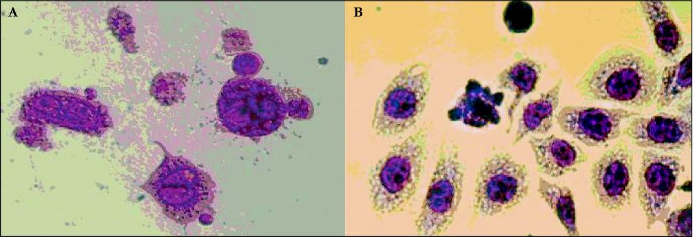 cancer cells under microscope. hela cells under optic