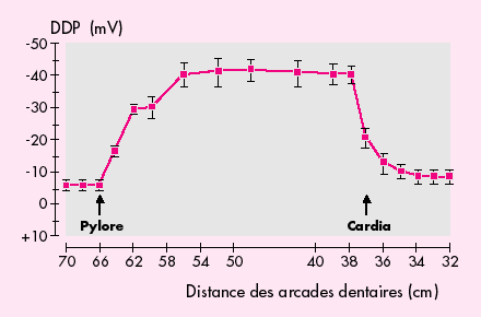 diagramme de différence de potentiel