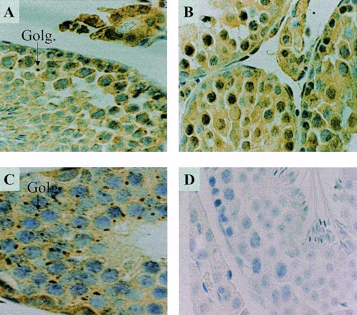 John Libbey Eurotext European Cytokine Network Over Expression Of Interleukin 1a Interleukin 1b And Interleukin 1 Receptor Antagonist In Testicular Tissues From Sexually Immature Mice As Compared To Adult Mice