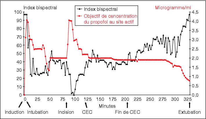 John Libbey Eurotext Journal De Pharmacie Clinique Impact Of Propofol And Sufentanil Target Controlled Infusion With Monitoring Of Bispectral Index On Drugs And Medical Devices Costs In Operating Room And