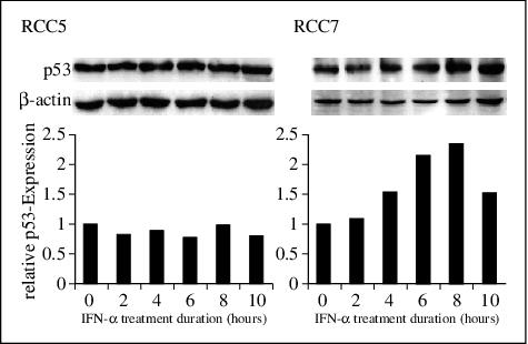 John Libbey Eurotext European Cytokine Network The Sensitivity Of Renal Cell Carcinoma Cells To Interferon Alpha Correlates With P53 Induction And Involves Bax