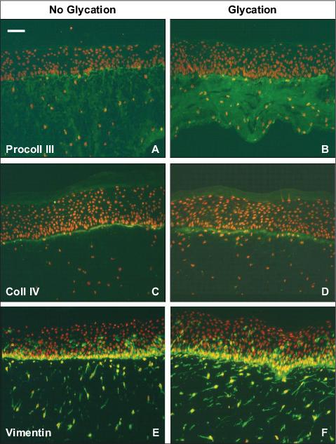 John Libbey Eurotext European Journal Of Dermatology Collagen Glycation Triggers The Formation Of Aged Skin In Vitro