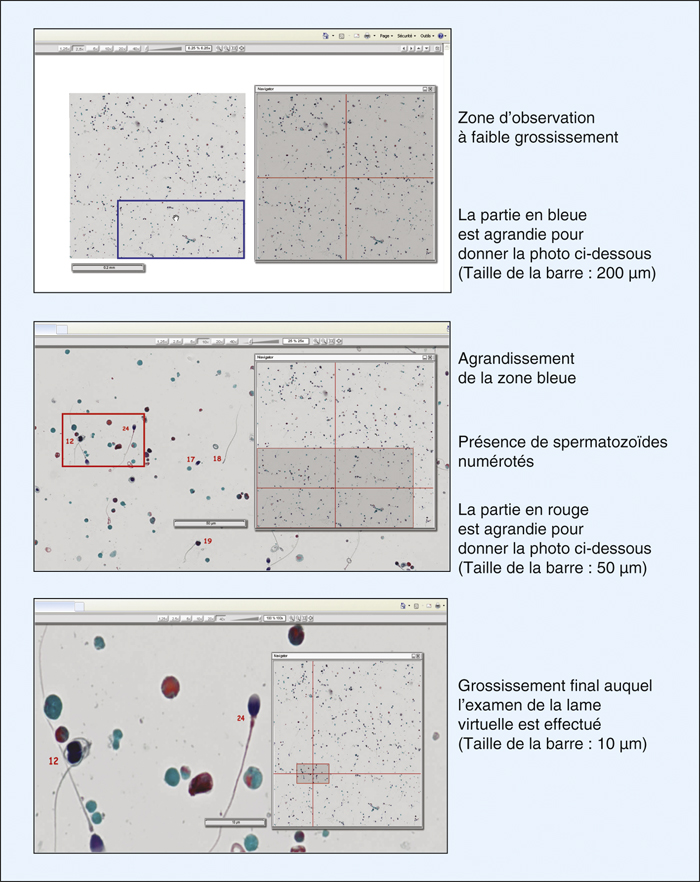 John Libbey Eurotext Annales De Biologie Clinique La Lame Virtuelle Un Nouvel Outil Pour Le Controle Externe De Qualite De L Analyse Morphologique Des Spermatozoides