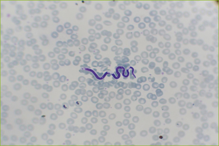 John Libbey Eurotext Medecine Et Sante Tropicales Mansonelliasis Identified By A Cervicovaginal Smear At The University Hospital Center Of Bobo Dioulasso Burkina Faso