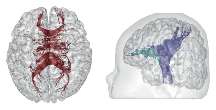 John Libbey Eurotext Medecine Therapeutique Pediatrie Mieux Comprendre Le Developpement Cerebral Grace Aux Nouvelles Techniques D Irm Anatomique Et Fonctionnelle Fantasme Scientifique Outil Clinique