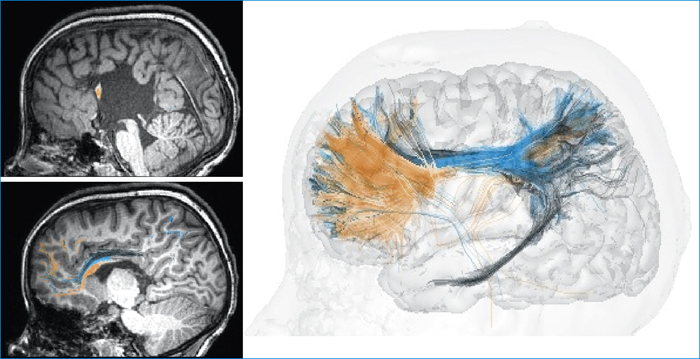 John Libbey Eurotext Medecine Therapeutique Pediatrie Mieux Comprendre Le Developpement Cerebral Grace Aux Nouvelles Techniques D Irm Anatomique Et Fonctionnelle Fantasme Scientifique Outil Clinique