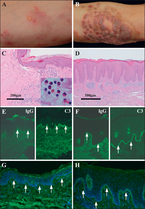 JLE - European Journal Of Dermatology - The Different Intensity Of ...