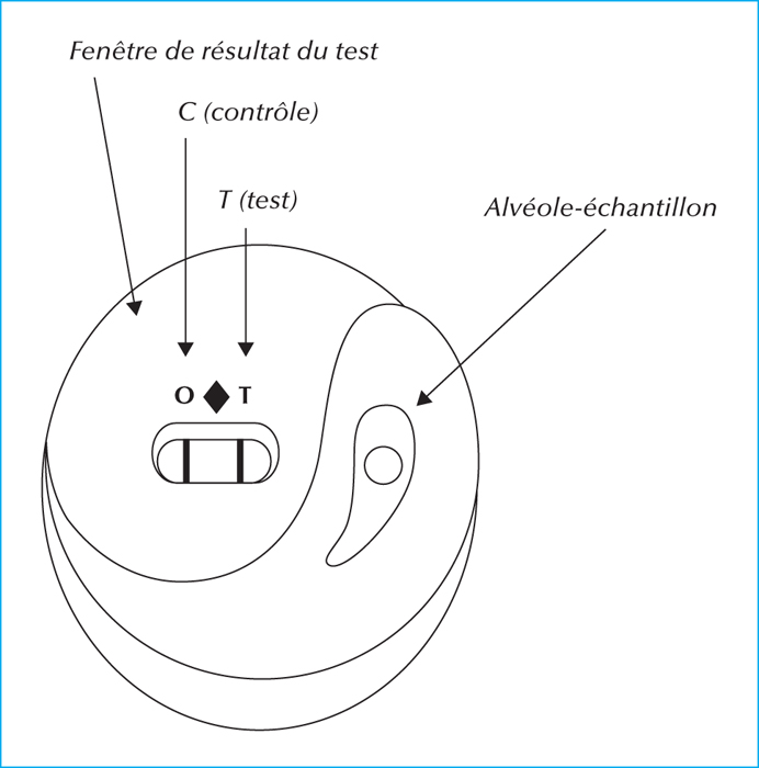 JLE - Médecine Thérapeutique / Pédiatrie - Test De Diagnostic Rapide ...