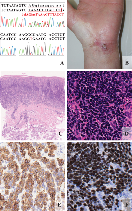 John Libbey Eurotext - European Journal of Dermatology - A follow-up ...