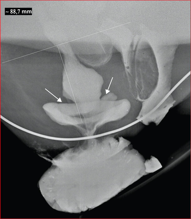 John Libbey Eurotext Hepato Gastro Oncologie Digestive Solitary Rectal Ulcer Syndrom Break Out Of Isolation