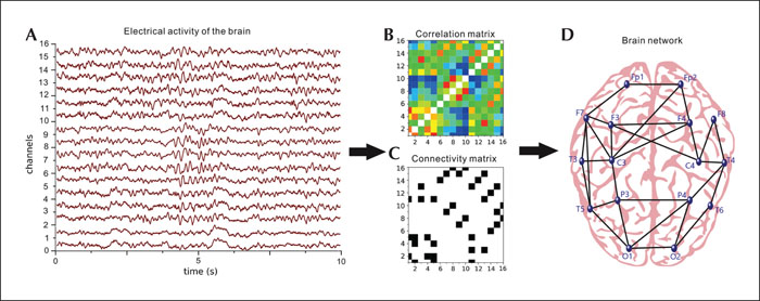 eeg brain