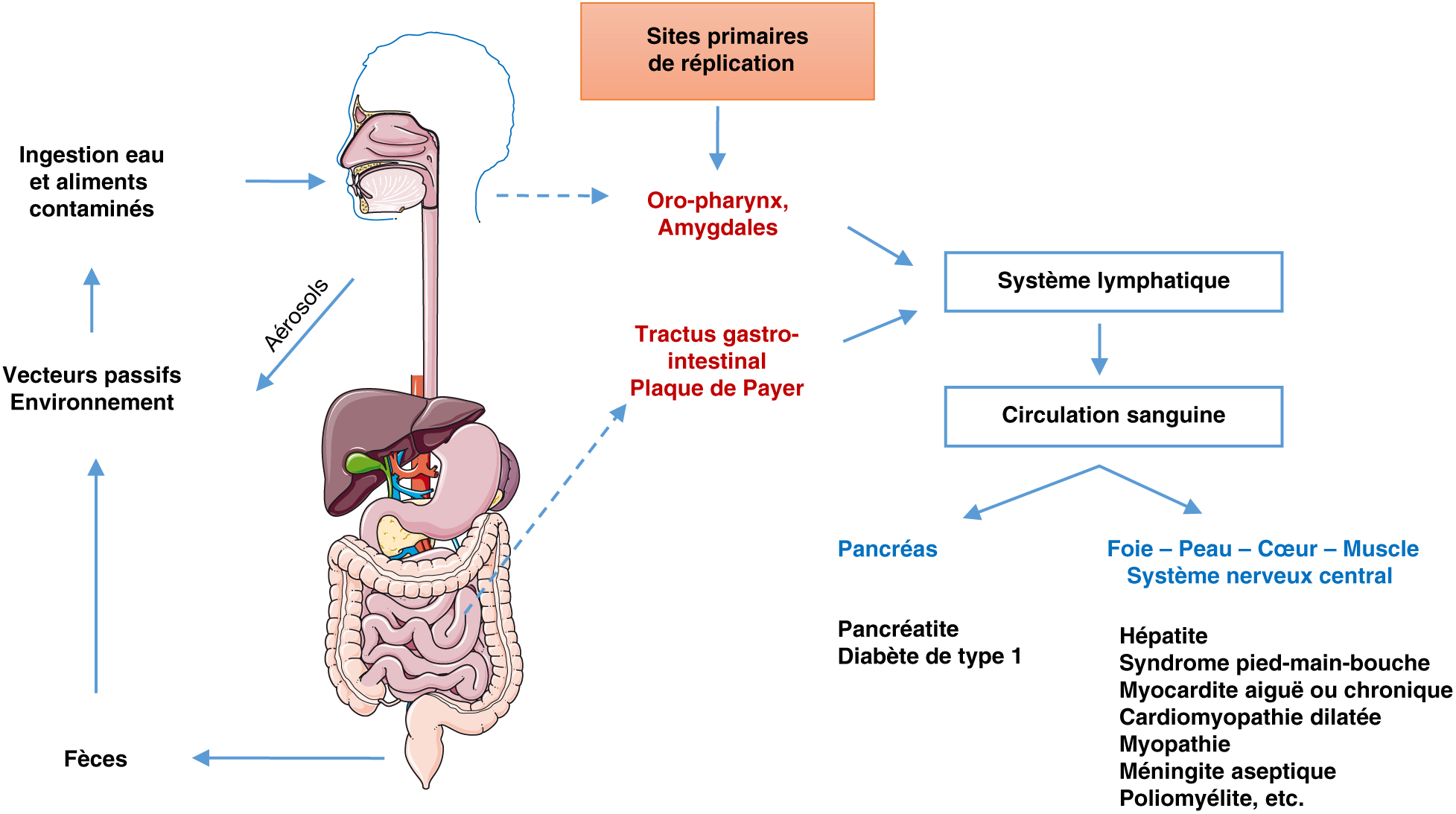 JLE - Virologie - Infection à Coxsackievirus B Et Pathogenèse Du ...