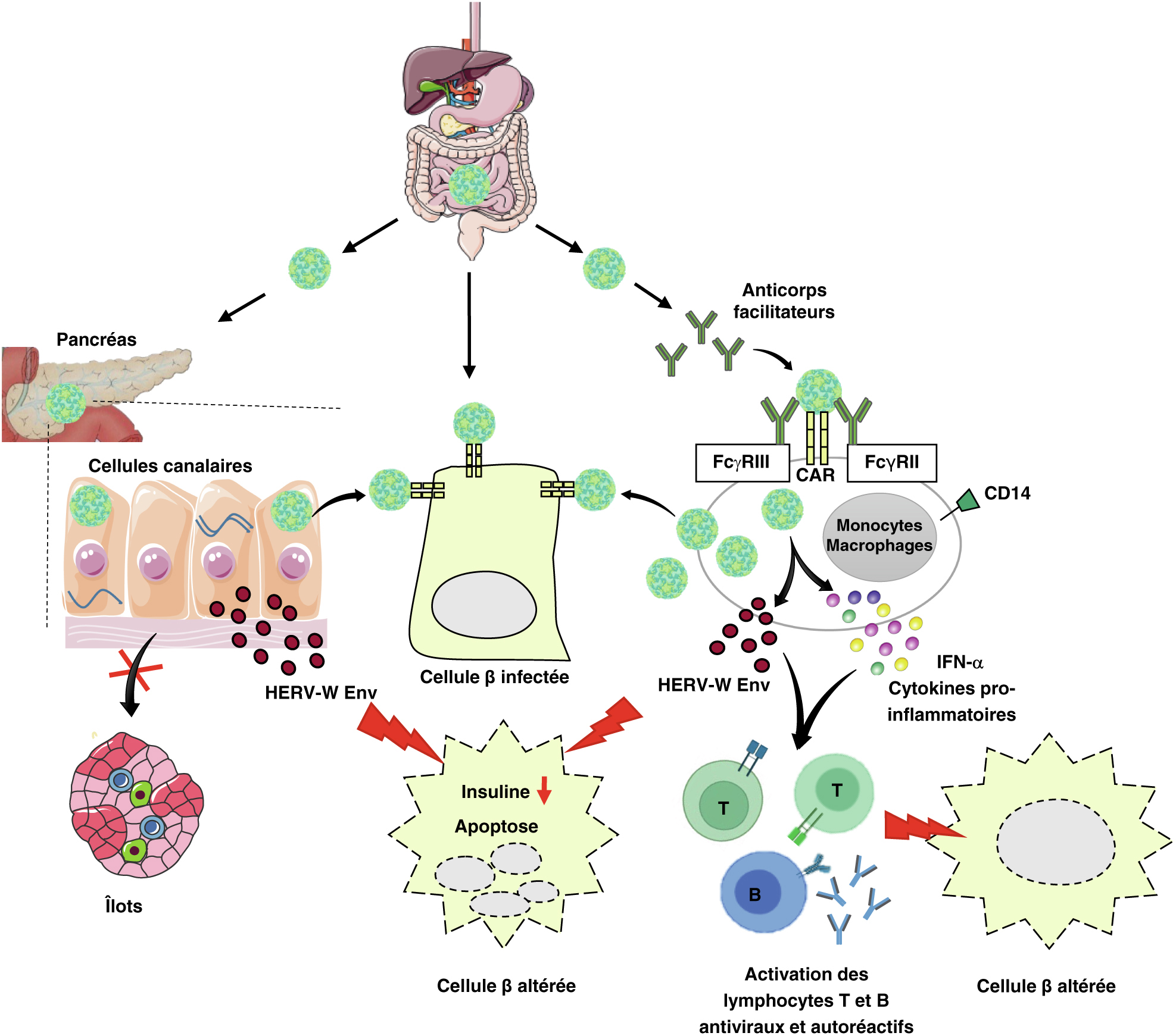 JLE - Virologie - Infection à Coxsackievirus B Et Pathogenèse Du ...