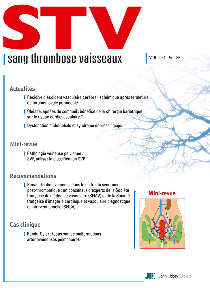 Sang Thrombose Vaisseaux